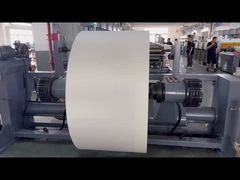 300-1200mm in lặp lại chiều dài in flexographic máy in cho gói túi bột